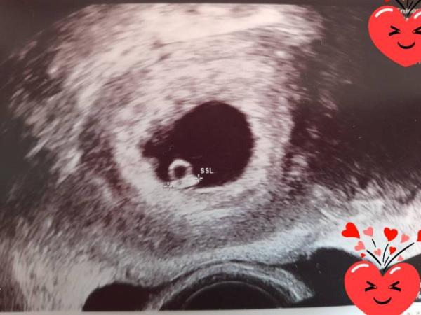 Bild zu 2. Termin Frauenärztin - Forum für Februar - Mamis