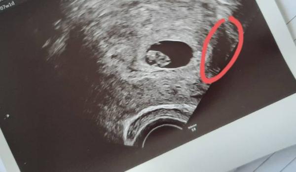 Bild zu Gemischte Gefühle.. - Forum für Februar - Mamis