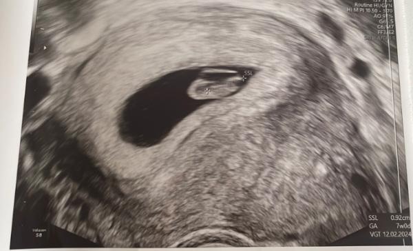 Bild zu Gibt es hier Ultraschall-Experten? - Forum für Februar - Mamis