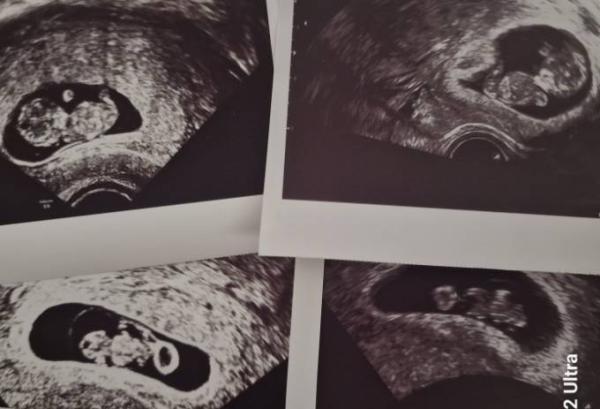 Bild zu Zurück vom Termin - Forum für Februar - Mamis