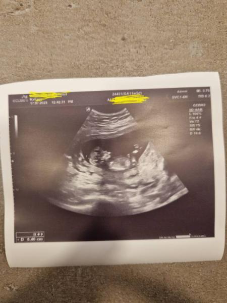 Bild zu Vordatiert und komischer Mund auf dem Bild - Forum für Februar - Mamis