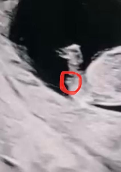 Bild zu Junge oder Mädchen ? - Forum für Februar - Mamis