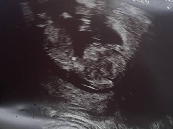 Bild zu Bei uns ist alles super, endlich! - Forum für Februar - Mamis