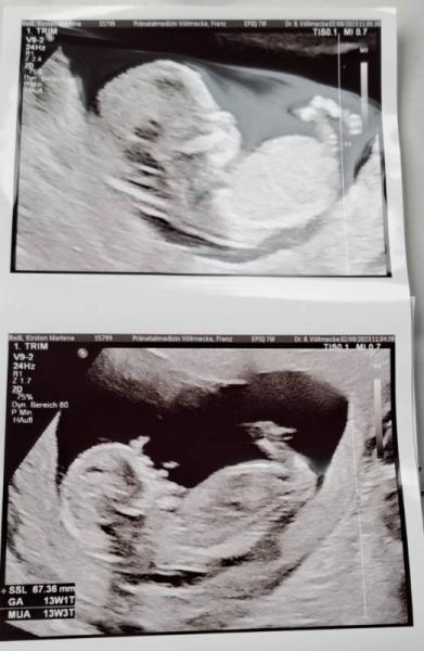 Bild zu Zurück vom Arzt termin - Forum für Februar - Mamis