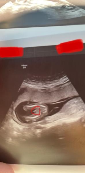 Bild zu Ist das eindeutig? - Forum für Februar - Mamis