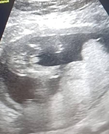 Bild zu Eindeutiger junge, was meint ihr? - Forum für Februar - Mamis
