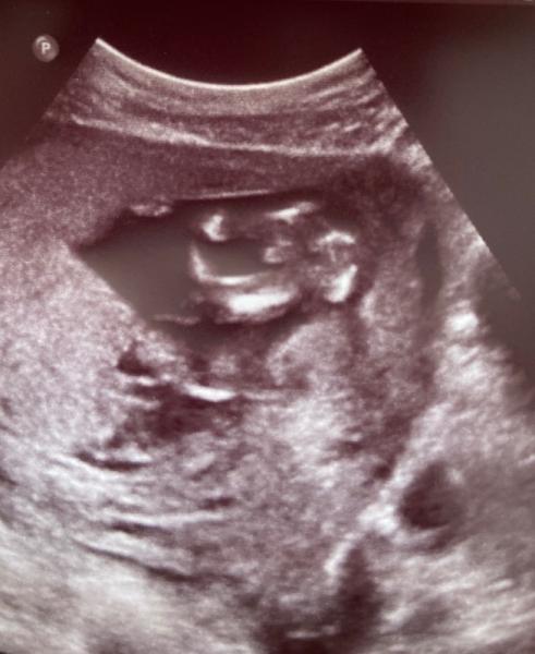 Bild zu Junge oder Mädchen - Forum für Februar - Mamis