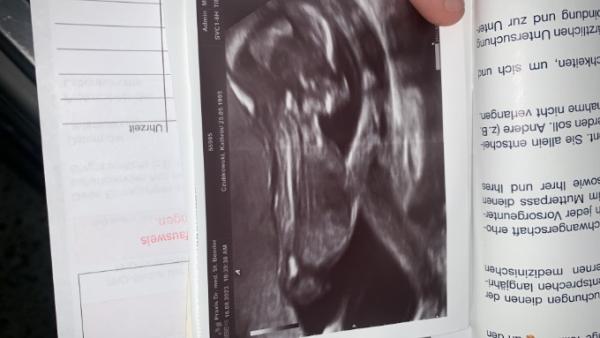 Bild zu Junge oder Mädchen - Forum für Februar - Mamis