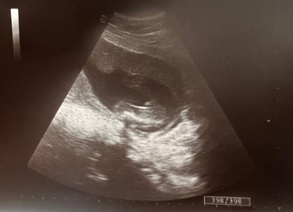 Bild zu Junge oder Mädchen? 🙈 - Forum für Februar - Mamis