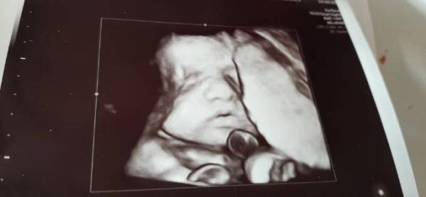 Bild zu Ultraschallbild❤ - Forum für Februar - Mamis