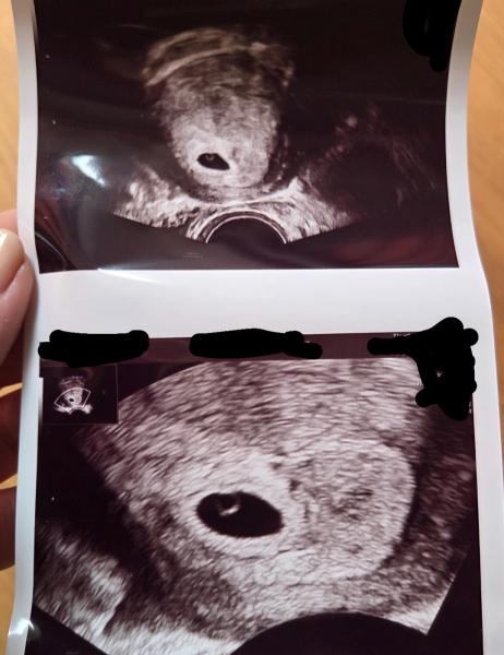 Bild zu Februar Baby im Bauch - Forum für Februar - Mamis