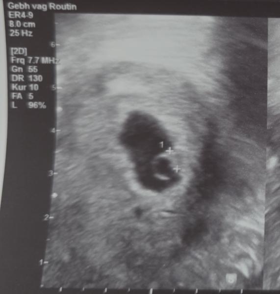 Bild zu 1. Ultraschall - Forum für Februar - Mamis