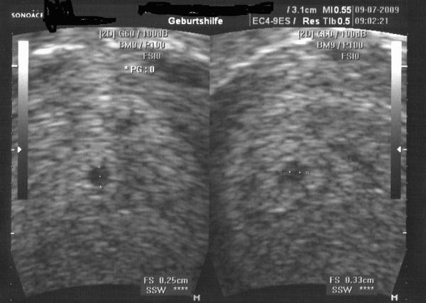 Bild zu ssw mit dem 4 - Forum für März - Mamis