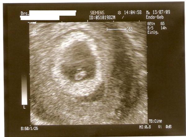 Bild zu Komm gerade vom FA - mit Bild :-) - Forum für März - Mamis