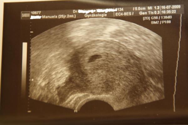 Bild zu Hatte heute 1. FA-Termin - Forum für März - Mamis