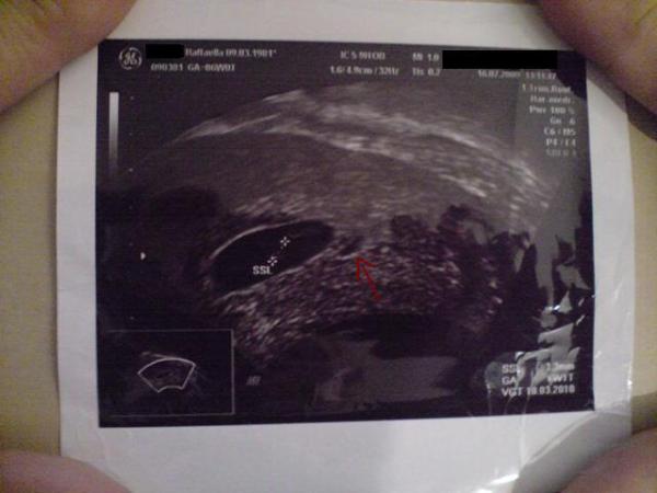 Bild zu jetzt muss ich doch euch mal fragen... - Forum für März - Mamis