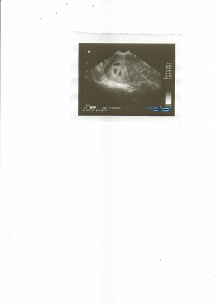 Bild zu Hab jetzt Foto verkleinert - Forum für März - Mamis