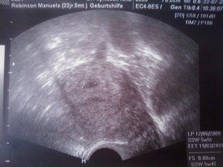 Bild zu HURRRRAAAAAA - Forum für März - Mamis