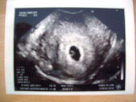 Bild zu Nachtrag Bild FA gestern - Forum für März - Mamis