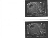 Bild zu hier ein bild von unserem böhnchen - Forum für März - Mamis