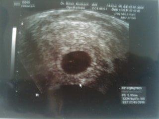 Bild zu hab ich ganz vergessen - Forum für März - Mamis