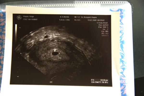 Bild zu US bIlder - Forum für März - Mamis