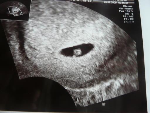 Bild zu Hier mein erstes us-bild in - Forum für März - Mamis