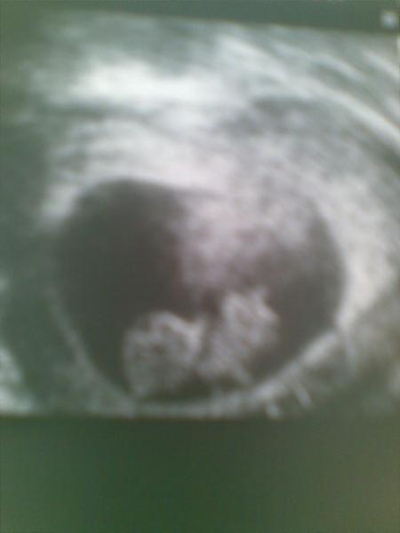 Bild zu ++ Bericht & Baby Bildchen :-) ++ - Forum für März - Mamis