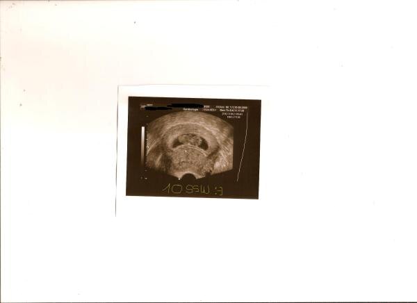 Bild zu Foto von meinem Bauchzwerg!! - Forum für März - Mamis