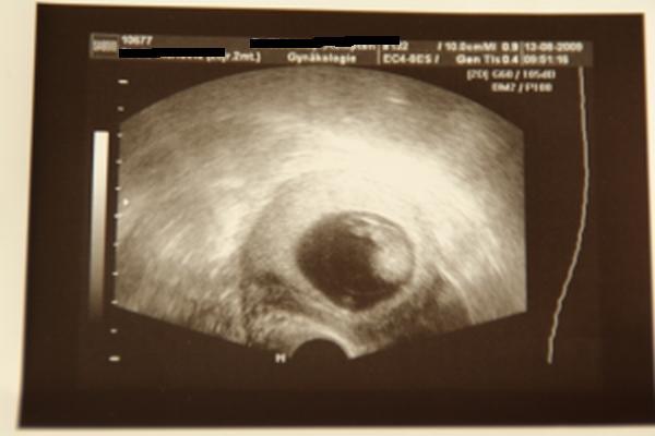 Bild zu War doch beim Doc.... - Forum für März - Mamis