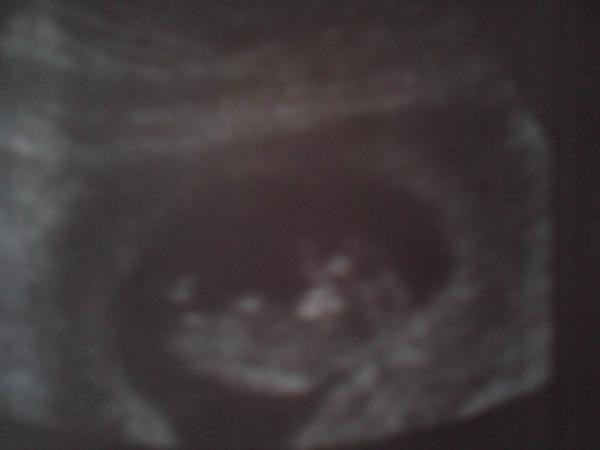 Bild zu Heute VU und Bildchen :-) - Forum für März - Mamis