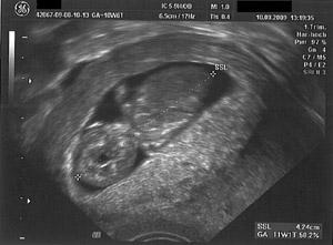 Bild zu US-Bildchen - Forum für März - Mamis