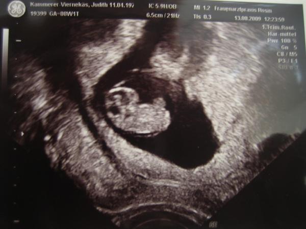 Bild zu mal wieder melden will - Forum für März - Mamis