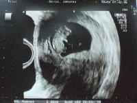 Bild zu Auch mal Bildchen zeigen will :-) - Forum für März - Mamis