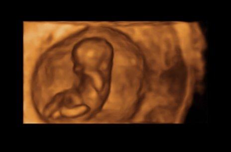 Bild zu Heute VU - mit Bildchen - Forum für März - Mamis