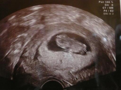 Bild zu hatte grad vu - Forum für März - Mamis