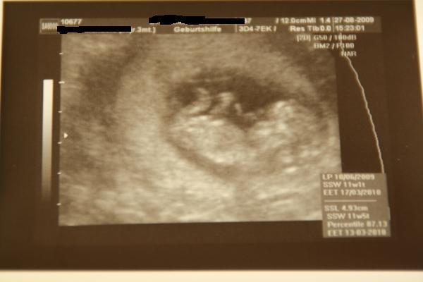 Bild zu FA Bericht mit Foto - Forum für März - Mamis