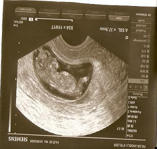 Bild zu komisch - Forum für März - Mamis