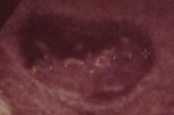 Bild zu War heute bein FA :) - Forum für März - Mamis