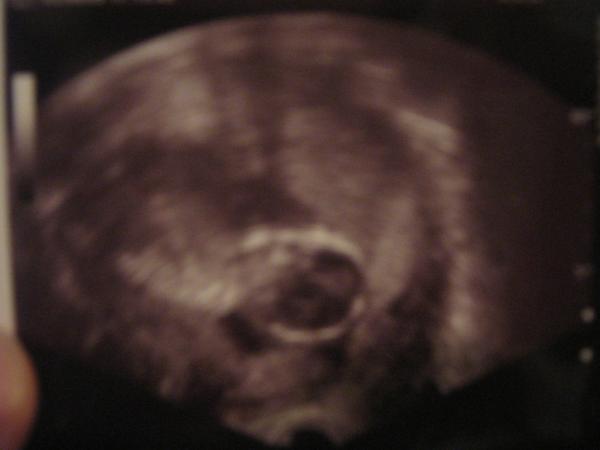 Bild zu War ja gestern beim FA... - Forum für März - Mamis