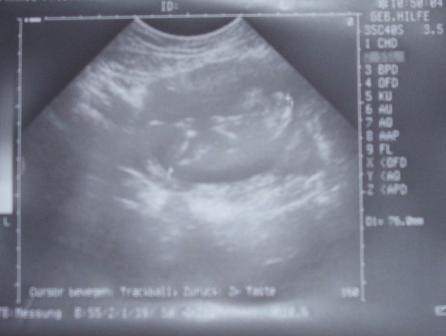 Bild zu VU Bericht mit Foto - Forum für März - Mamis