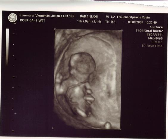 Bild zu Neues vom Baby - Forum für März - Mamis