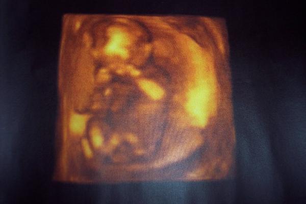 Bild zu Supersüsses Bild - Forum für März - Mamis