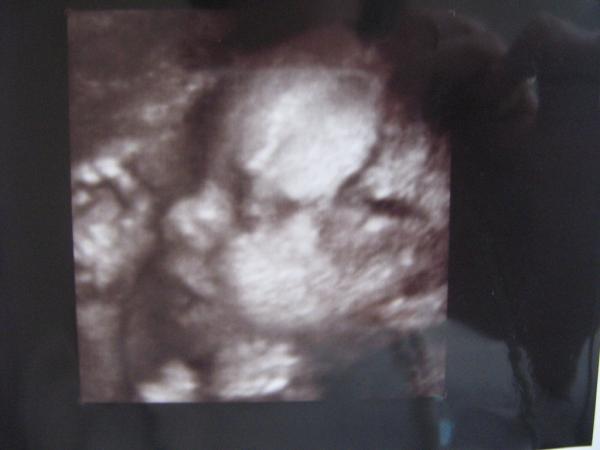 Bild zu Hier mal 3D Bilder aus meiner ersten SS!! - Forum für März - Mamis