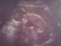 Bild zu Noch Bildchen von gestern ... - Forum für März - Mamis