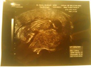 Bild zu US bildchen von gestern! - Forum für März - Mamis