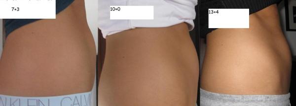 Bild zu Mein Bauch wird nie dick werden glaub ich- Bild! - Forum für März - Mamis