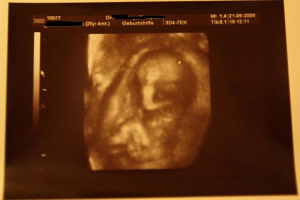 Bild zu Zurück vom FA mit 3D Bildchen - Forum für März - Mamis