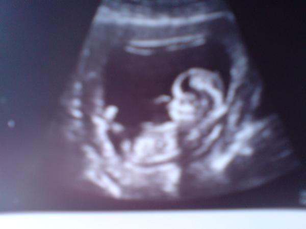 Bild zu und hier stelle ich mich/uns wohl auch nochmal vor;-) - Forum für März - Mamis