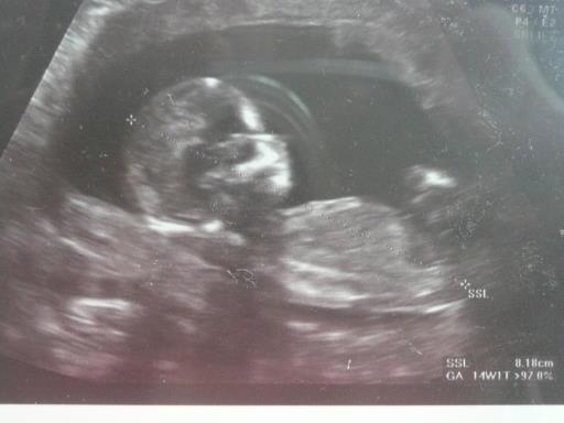 Bild zu gestern vu - Forum für März - Mamis